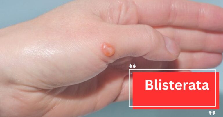 Blisterata - Everything Here To Know!