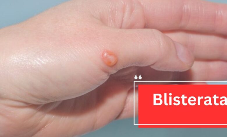 Blisterata - Everything Here To Know!